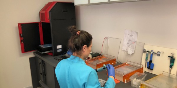 imager fx, imager Cfx, imagER, imager eyes, jel görüntüleme sistemi, gel imager, imagER Fx, gen-box, Biyoteknoloji, Biotechnology, ER Biyotek, ER Biotech, intergen