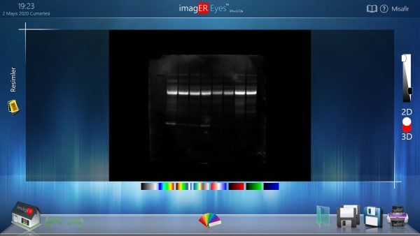 er biyotek, erbiyotek, gen-box, genbox, imager, western blot, imager fx, imager Cfx, imagER, imager eyes, jel görüntüleme sistemi, gel imager, imagER CFx mini, gen-box imager fx mini, Biyoteknoloji, Biotechnology, ER Biyotek, ER Biotech, biyo-görüntüleme, UV görüntüleme, kemilüminesan görüntüleme, floresan görüntüleme, uv görüntüleme, agaroz jel görüntüleme, western blot, ECL, ECL Plus, chemi imager, kemilüminesans görüntüleme, yerli üretim, UV lamba, 302nm lamba, 365nm lamba, 254nm lamba, transilüminatör, moleküler biyoloji ve genetik bölümü, Türkiye, Turkey, made in Turkey, yerli üretim, yerli ve milli