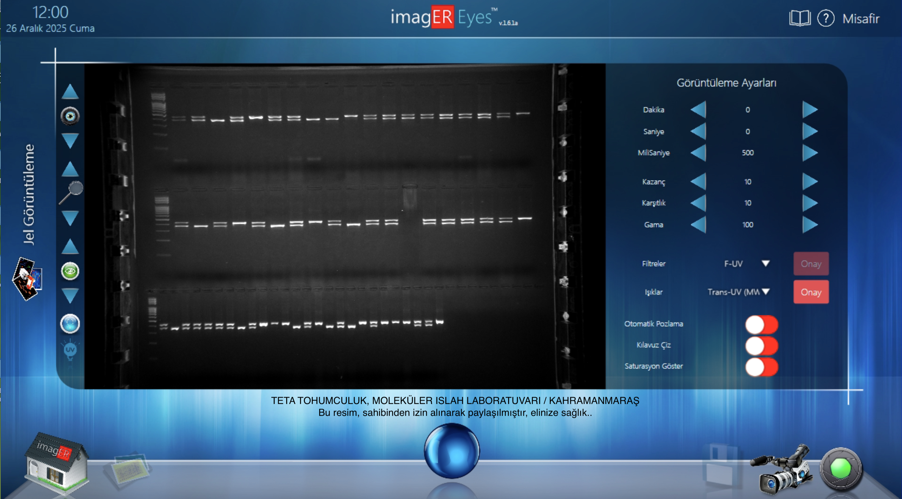 er biyoteknoloji, er biyotek, erbiyotek, gen-box, genbox, imager, western blot, imager fx, imager Cfx, imagER, imager eyes, jel görüntüleme sistemi, gel imager, imagER CFx mini, gen-box imager fx mini, Biyoteknoloji, Biotechnology, ER Biyotek, ER Biotech, biyo-görüntüleme, UV görüntüleme, kemilüminesan görüntüleme, floresan görüntüleme, uv görüntüleme, agaroz jel görüntüleme, western blot, ECL, ECL Plus, chemi imager, kemilüminesans görüntüleme, yerli üretim, UV lamba, 302nm lamba, 365nm lamba, 254nm lamba, transilüminatör, moleküler biyoloji ve genetik bölümü, Türkiye, Turkey, made in Turkey, yerli üretim, yerli ve milli